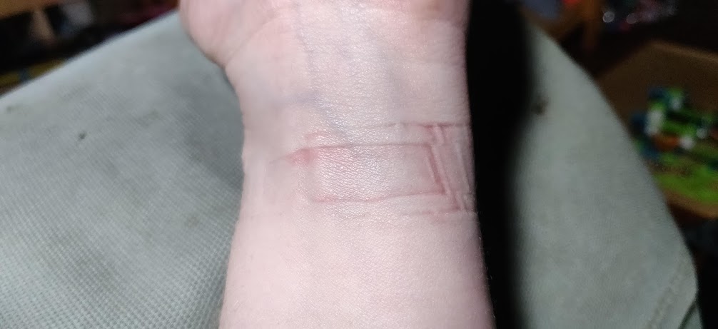marks left on my wrist from the watch strap